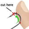 Remove a Fishhook From a Finger
